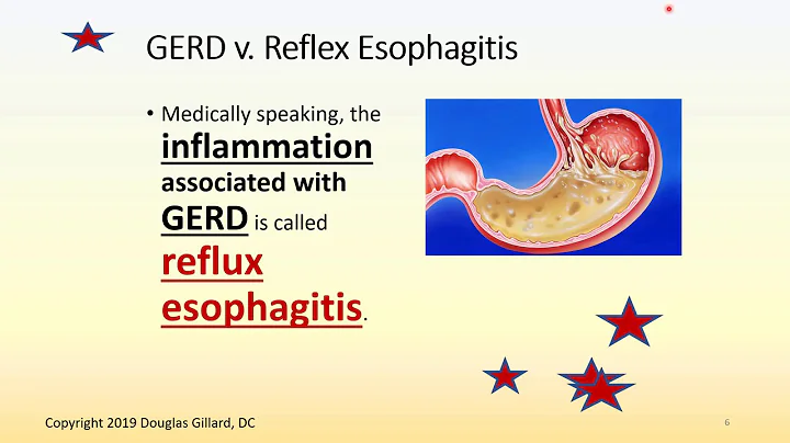 Gastroesophageal Reflux Disease: an Advanced Lectu...