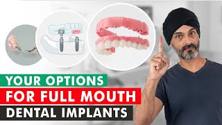 Replacing All Your Teeth: Which Implant Solution is Right for You?