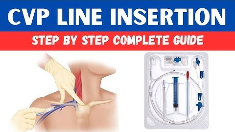 Central Venous Catheter (CVC) Insertion Procedure: Step-by-Step Guide for Medical Professionals