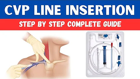 Central Venous Catheter (CVC) Insertion Procedure: Step-by-Step Guide for Medical Professionals