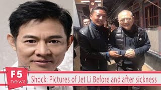 Shock: Pictures of Jet Li Before and after sickness