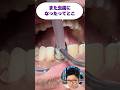 虫歯があった所を樹脂で直す!先生が解説!#shorts
