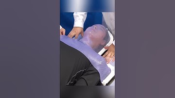 Why Radiotherapy Masks Are Used in Cancer Treatment | LEARNERBYTES