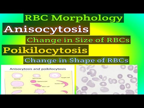 Video: Anisocytosis - Signs, Treatment, Causes, Forms, Diagnosis