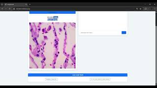 LungcareAI app screenshot 2