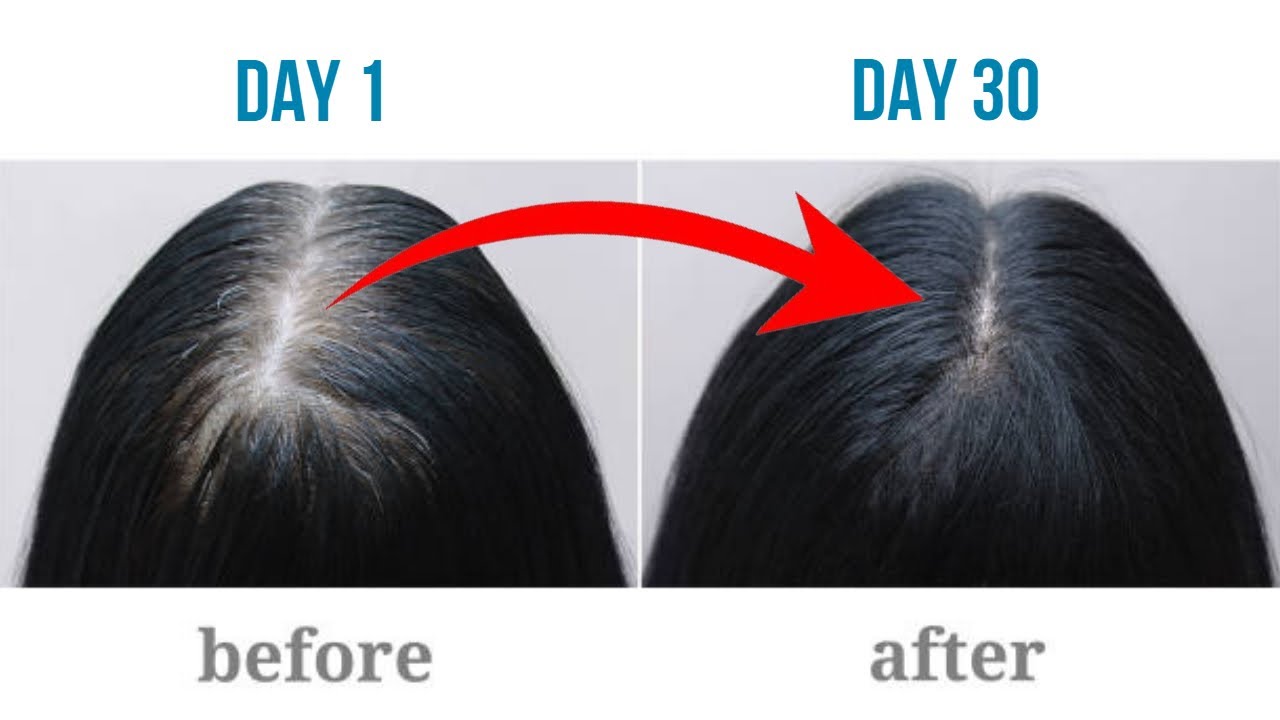 13 PROVEN Ways To Get THICKER Hair In JUST 30 Days - Here's How! - YouTube