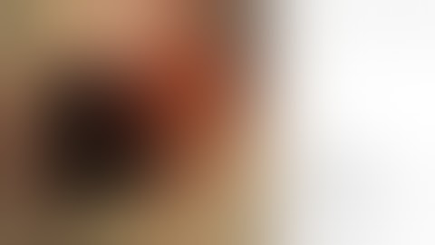 OTSC® System | Duodenal ulcer bleeding