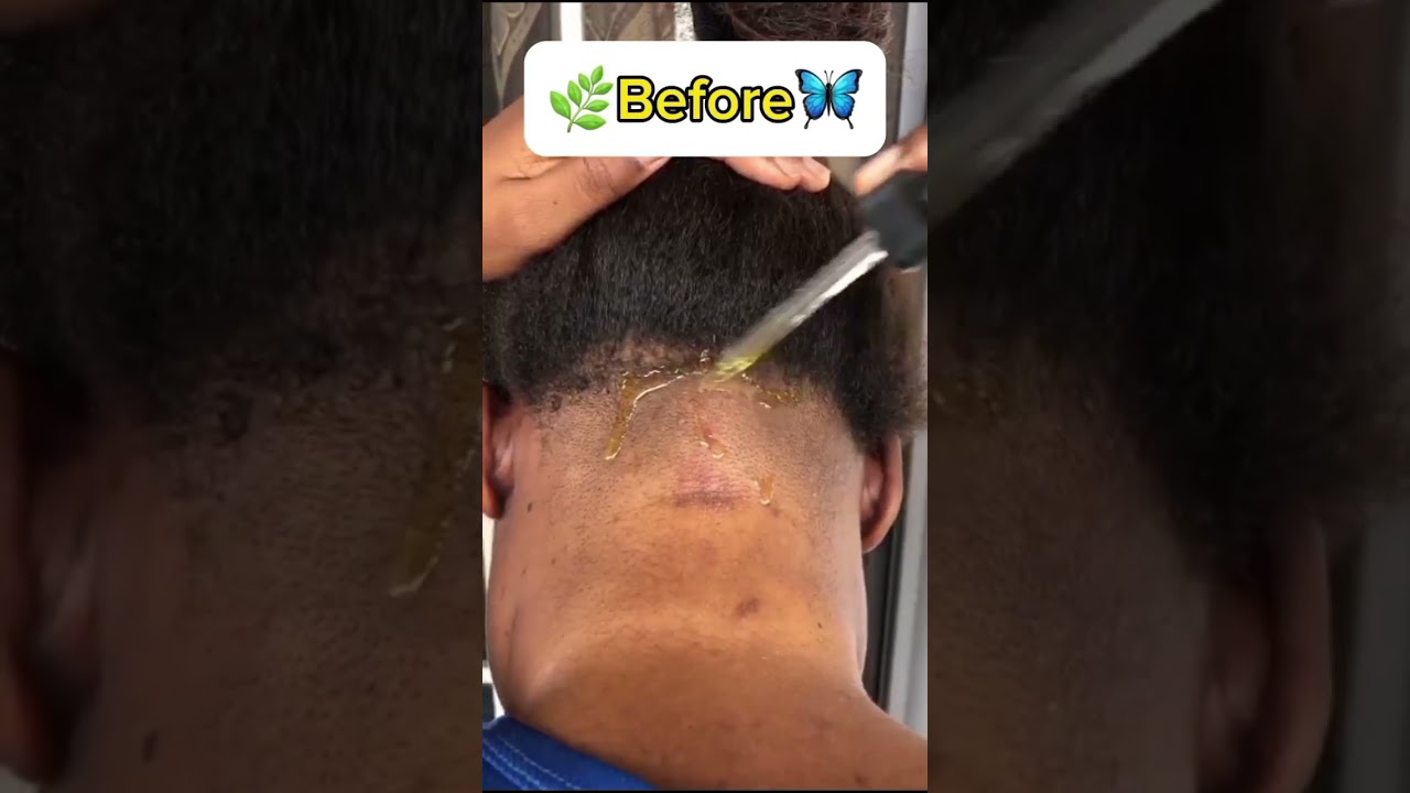 Unbelievable this growth oil works wonders 