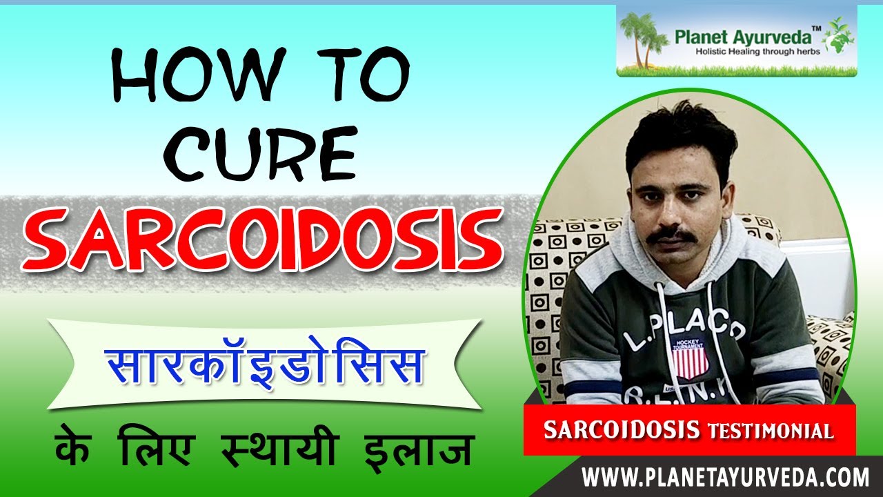 Watch Video Sarcoidosis Treatment is Possible in Ayurveda - Permanent Cure