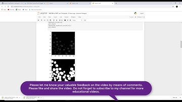 Convolutional Networks for Biomedical Image Segmentation (U-Net)