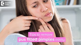 How to get rid of pus filled pimples? - Dr. Rasya Dixit
