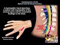 Compression of the Spinal Cord & Hand Function - Everything You Need To Know - Dr. Nabil Ebraheim