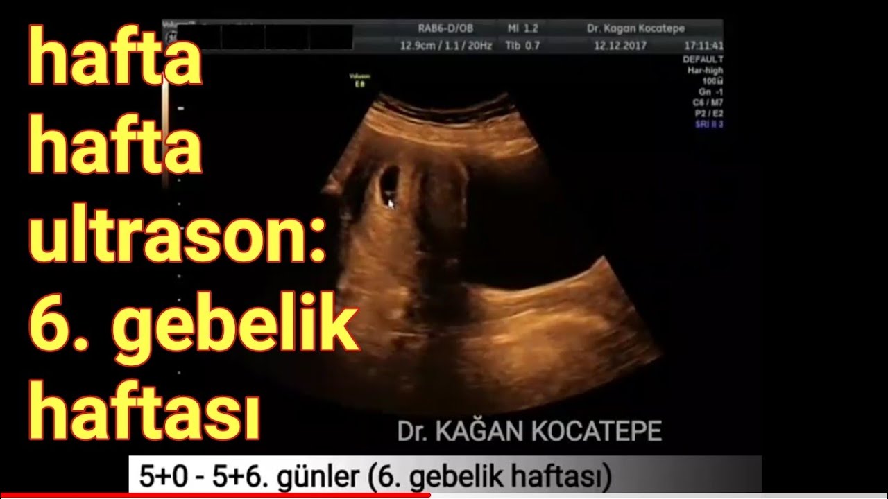 6 gebelik haftasinda anne karnindaki bebek aciklamali ultrason goruntuleri youtube