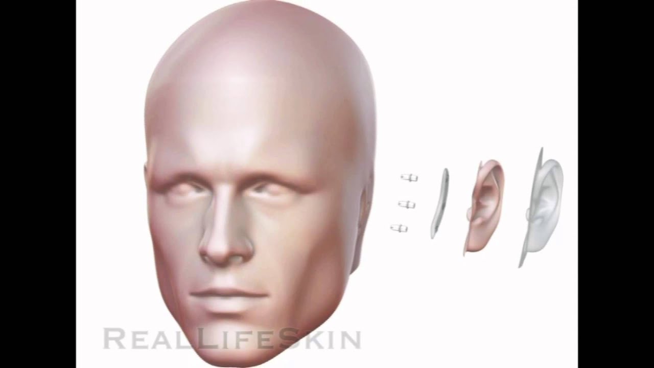 RealLifeSkin Ear Prosthesis
