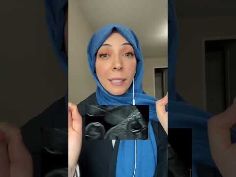 الشيخ محمد بن راشد يكرم جراح قلب الاطفال السعودي بجائزة نوابغ العرب