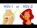 Whats the difference between hsv1 and hsv2 explained in 2 minutes