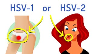 What's the Difference Between HSV-1 and HSV-2 (Explained in 2 minutes)