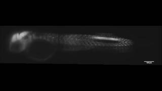 OpenSPIM: an open-access light-sheet microscopy platform 1