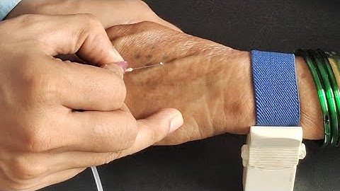 How to Insert a Scalp Vein Set: Step-by-Step Guide #medicalprocedures #scalpvein #butterflyneedle