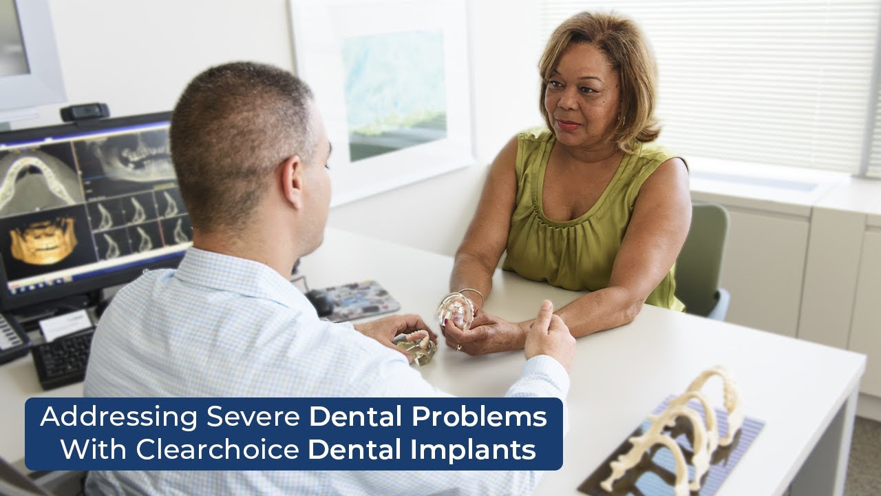 ClearChoice Dental Implants: A Life-Changing Fix for Severe Tooth Loss 🦷✨