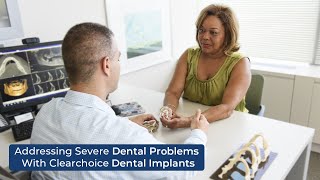 Addressing Severe Dental Problems with ClearChoice Dental Implants