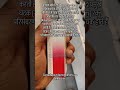 Dysmenorreha Period problem. Irregular ya pain.