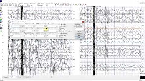 MEG/EEG Waveform analysis.
