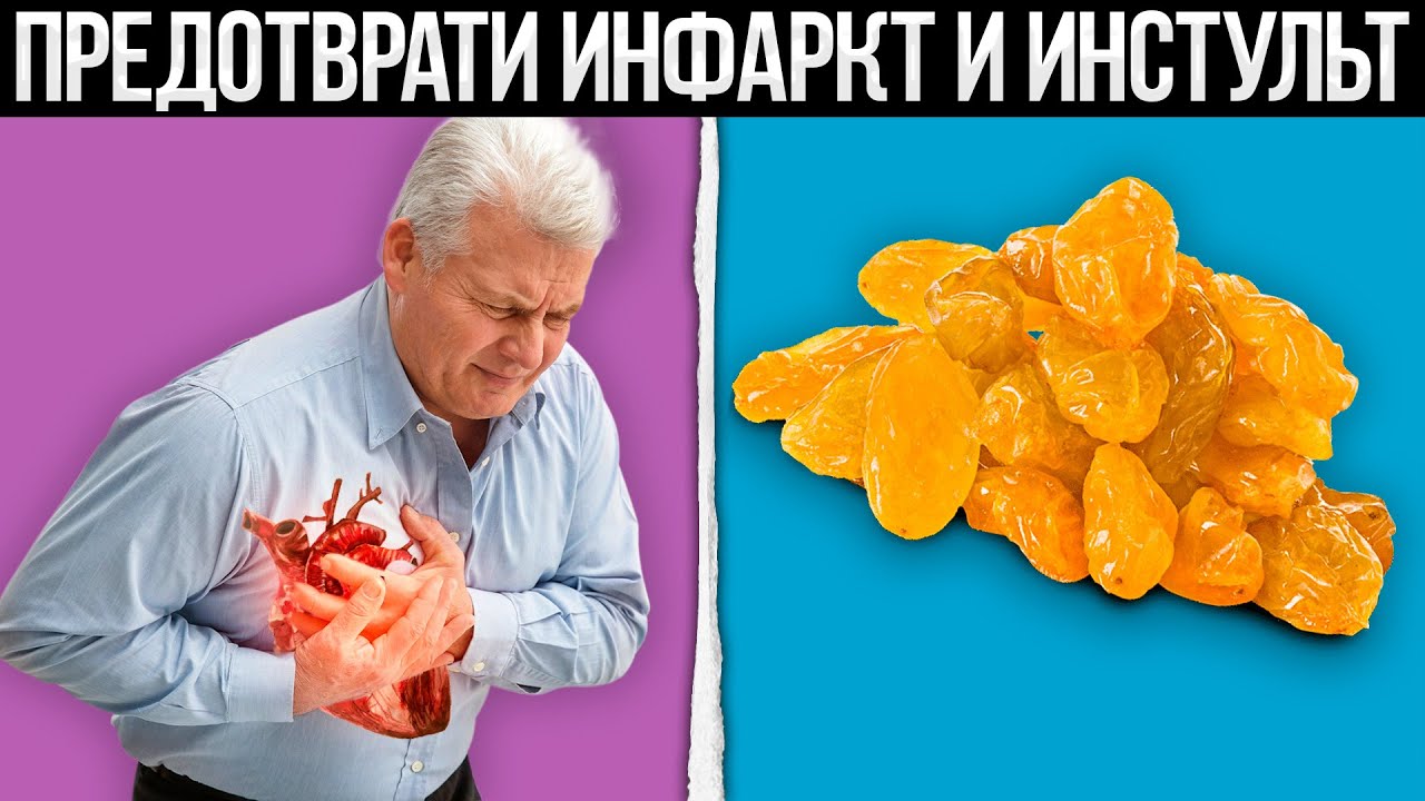 11 продуктов для СЕРДЦА, СОСУДОВ и ДОЛГОЛЕТИЯ. С каждым перекусом снижается риск ИНФАРКТА и ИНСУЛЬТА