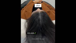 머리숱 많아보이는 법 #두피문신  #탈모 #가르마 #여자탈모