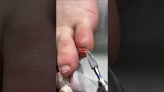 Most Satisfying Pedicure Transformation #nails #pedicure #satisfying #shorts