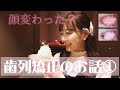 【渡辺美優紀】歯列矯正のお話①【みるきー】