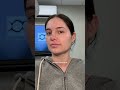 Nano Laser Peel Results After 7 Days | Before & After Glow