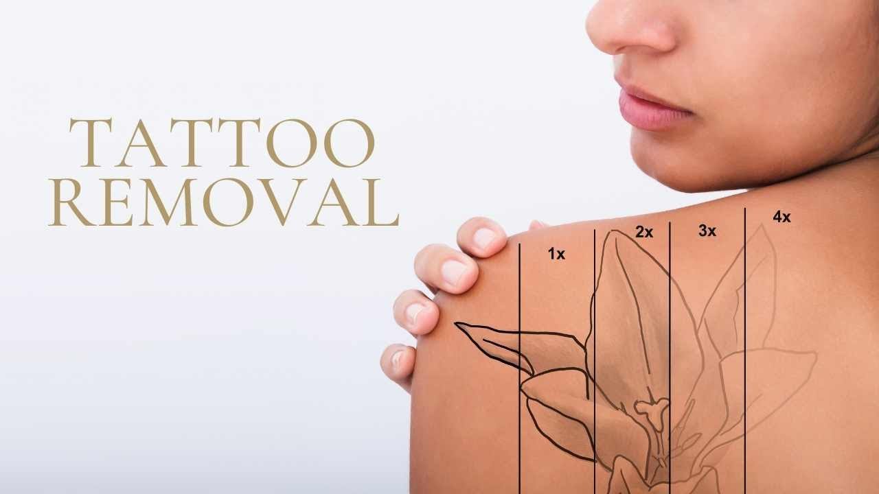 Tattoo Removal Course Australia | Golden Brows Academy