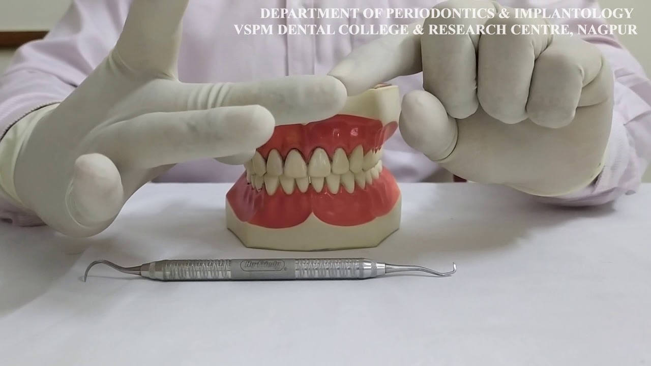 VIDEO ON MODIFIED PEN GRASP YouTube