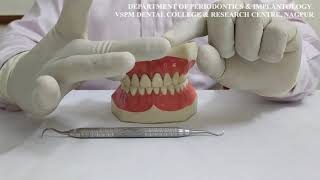 VIDEO ON MODIFIED PEN GRASP