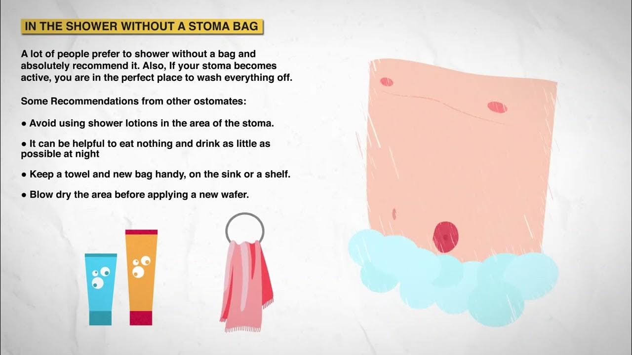 Showering With An Ostomy YouTube