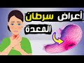 أعراض سرطان المعدة 