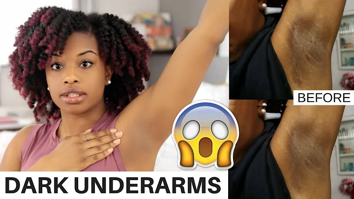 How To Lighten Dark Underarms Naturally and Fast |...