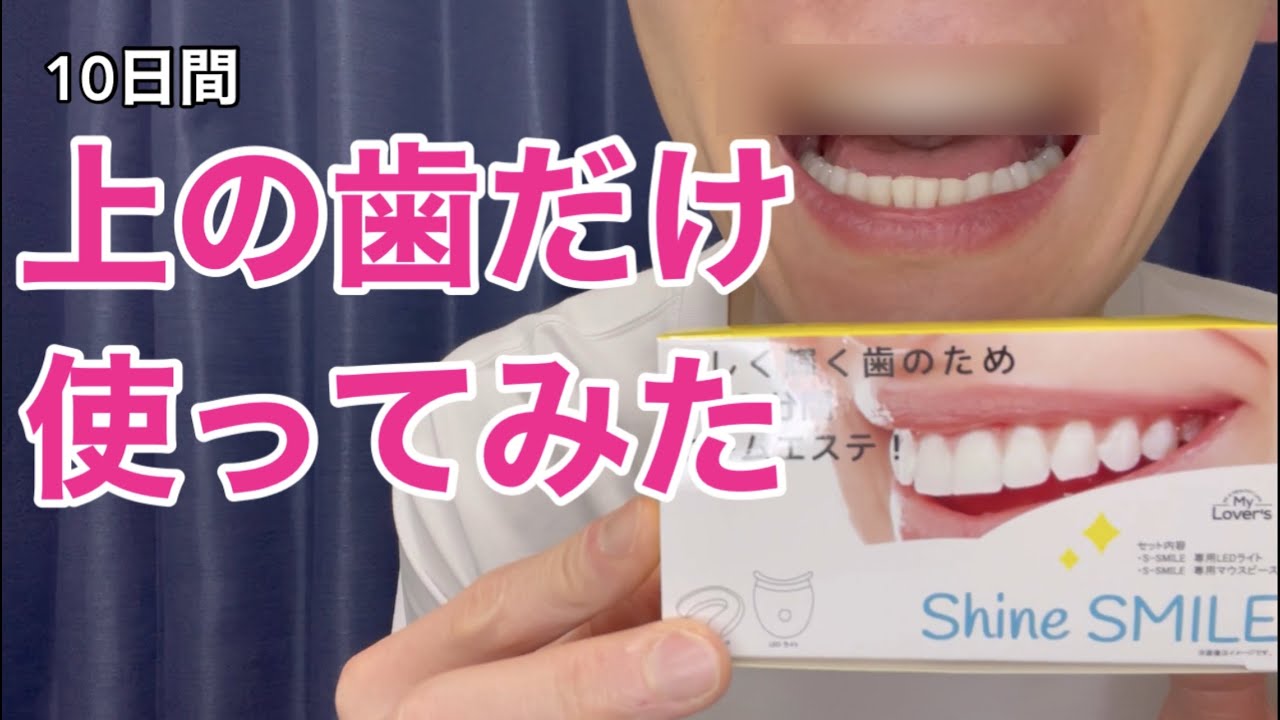 ホワイトニング】 上の歯だけLEDライトのホームホワイトニングをやって