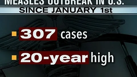 Surge in U.S. measles outbreak