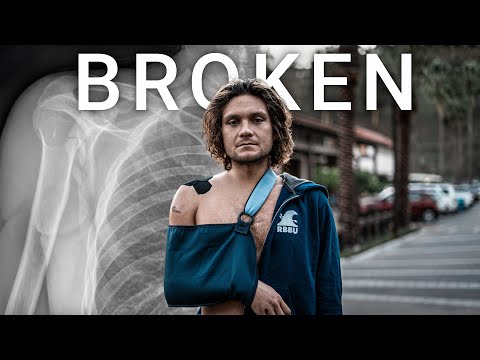 WORST BIKE CRASH OF MY LIFE – Mattox Time: Episode 1