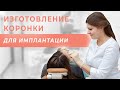 Изготовление коронок с применением цифровых технологий