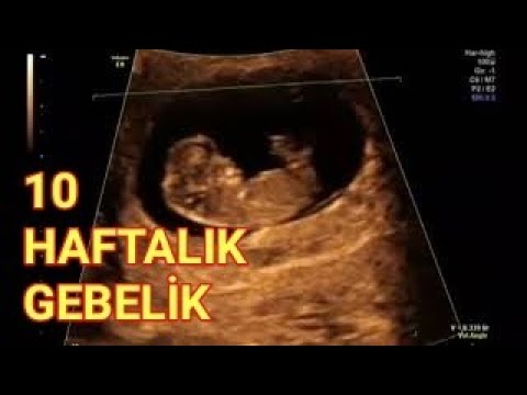 2 ay 10 gunluk 10 haftalik gebelik 11 haftada bebek ultrasonda nasil gorunur youtube