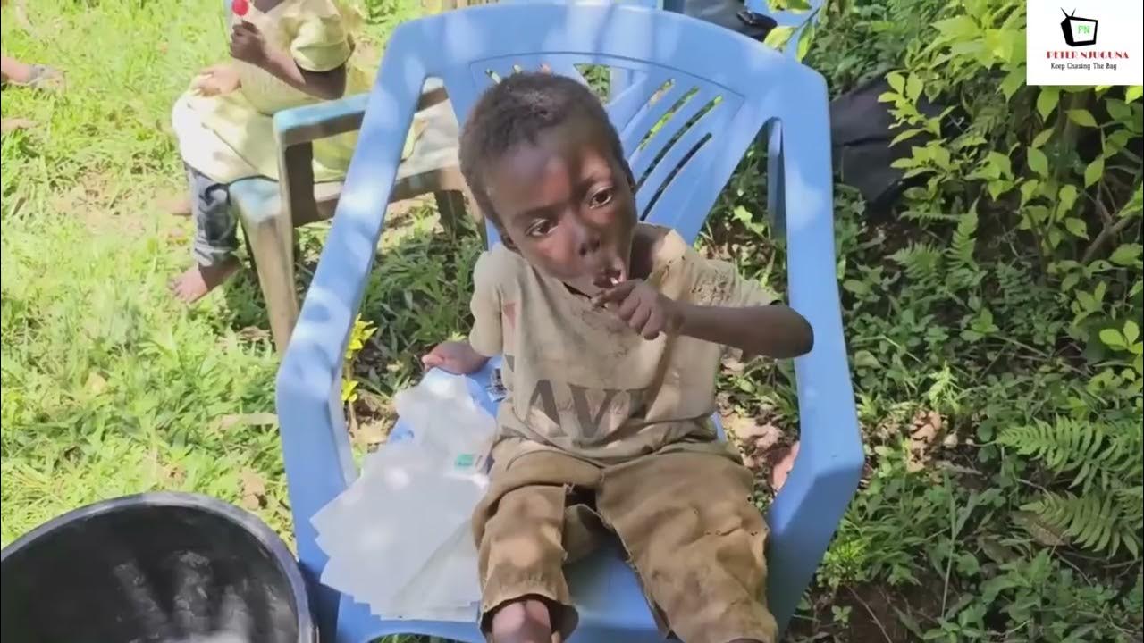 Jiggers Extraction YouTube