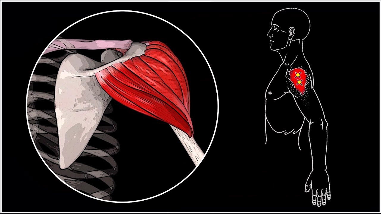 Боль в правом плече мышцы