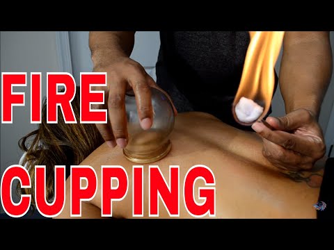 how-to-do-fire-cupping-&-deep-tissue-massage-using-a-tens-unit-for-muscle-recovery-for-athletes