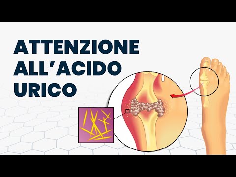 Analisi del sangue: