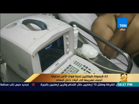 رأى عام 62 كبسولة كوكايين تحبط قوات الأمن محاولة أجنبي تهريبها إلى البلاد داخل أمعائه