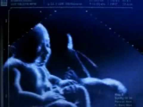 Final Countdown Baby sonogram