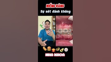 Sét Đánh! Niềng răng không phải lo đâu #nhakhoa #rang